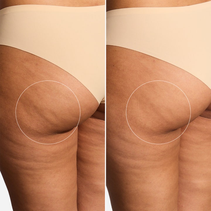 Brazilian Bum Bum Cream
