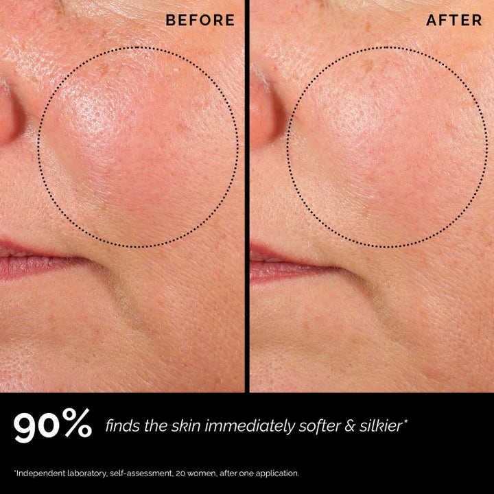 Skin Regimen Longevity Collagen+ Serum 30 ml opstrammende serum før og efter resultat der viser blødere hud