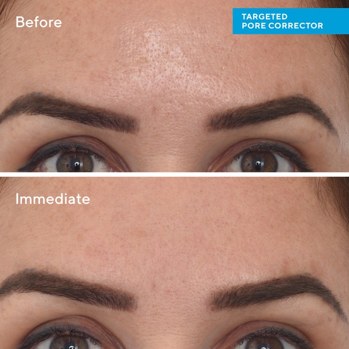 Murad Targeted Pore Corrector 15 ml spot treatment før og efter resultat som viser øjeblikkeligt udglattede porer