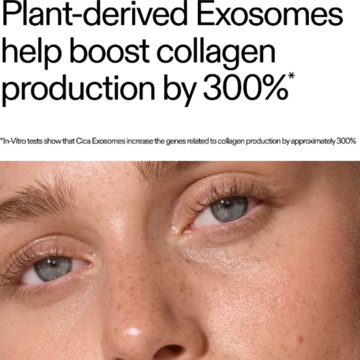 The INKEY List Exosome Hydro-Glow Complex 30 ml serum booster kollagen med 300% vist på glødende hud med fregner