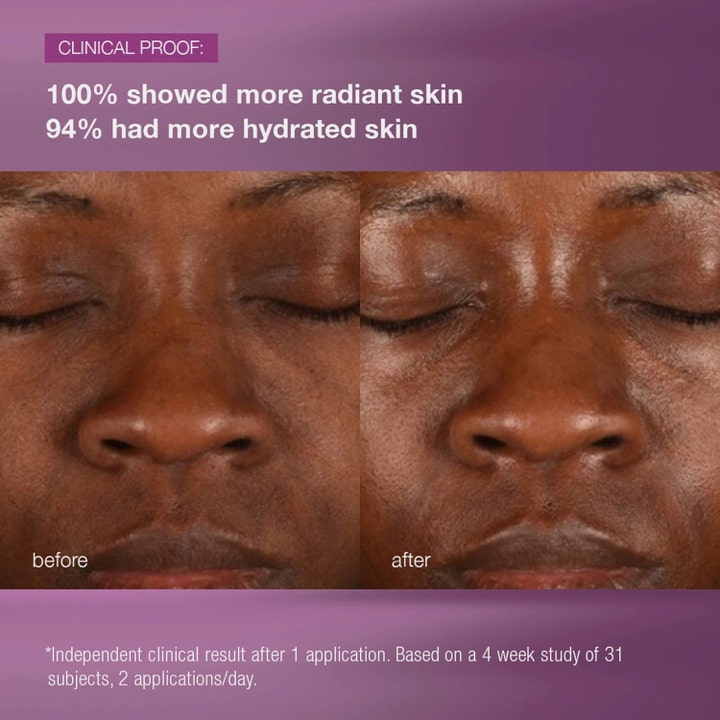 Dermalogica MultiVitamin Power Recovery Cream 50 ml før og efter resultat giver mere glød og fugtet hud
