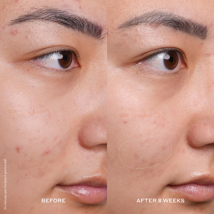Ole Henriksen Banana Bright Vitamin C Serum 30 ml serum viser før og efter resultater på rødme og tekstur efter 8 uger