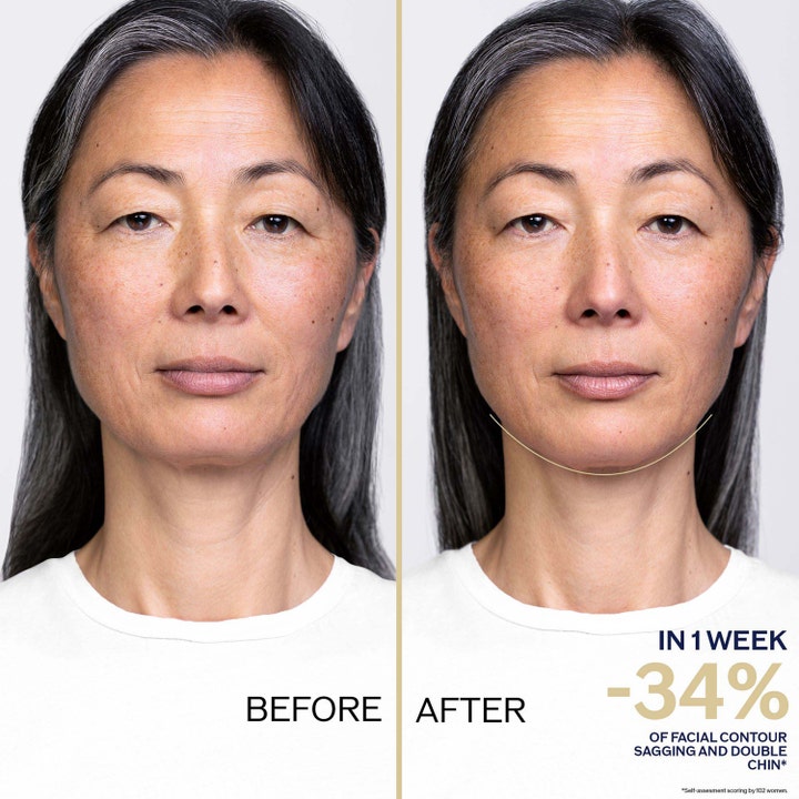 Shiseido Vital Perfection Overnight Firming Treatment 80 ml opstrammende creme før og efter resultat på ansigtskontur