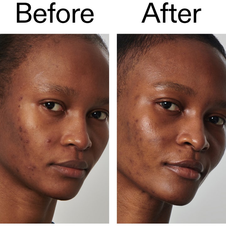 Niacinamide Serum