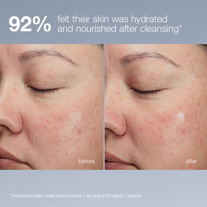 Dermalogica Magnetic Afterglow Cleanser 295 ml fugtgivende ansigtsrens før og efter resultater af hydreret hud.