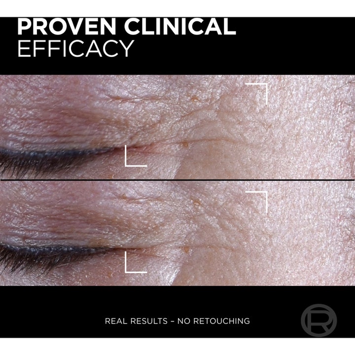 L'Oréal Paris Age Perfect Cell Renewal Midnight Eye Cream 15 ml øjencreme viser proven clinical efficacy mod rynker