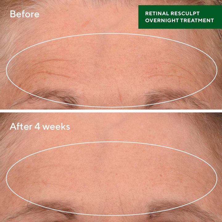 Murad Retinal ReSculpt Treatment 30 ml opstrammende serum med før og efter resultat på panderynker efter 4 uger
