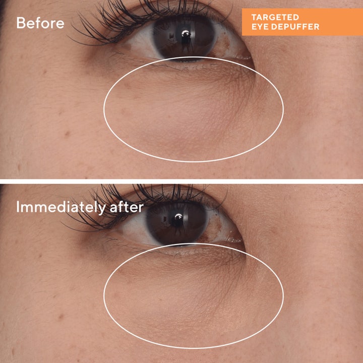 Murad Targeted Eye Depuffer 15 ml øjencreme der reducerer hævelser vist med før og efter resultater.