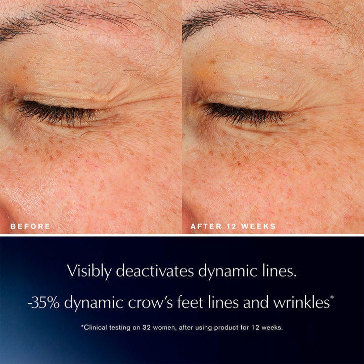 Estée Lauder Advanced Night Repair Eye Lift + Sculpt 15 ml øjenserum før og efter 12 uger viser færre smilerynker
