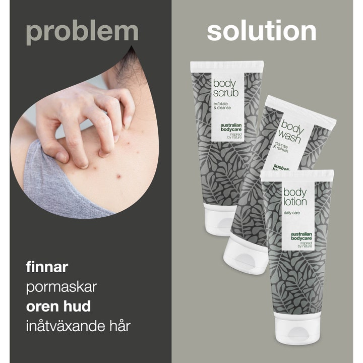 Australian Bodycare 3 kropsprodukter mod uren hud og bumser vist som løsning i hvide tuber med Tea Tree Oil.
