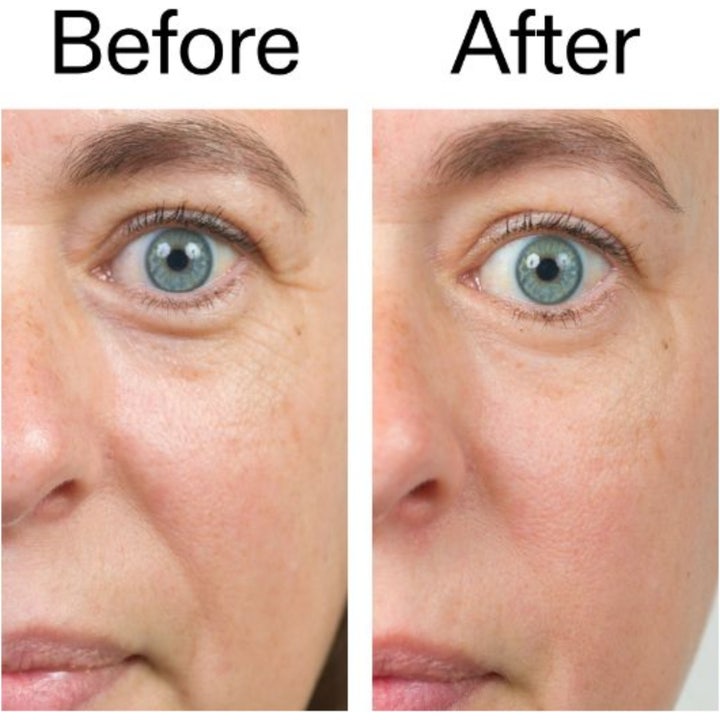 The INKEY List Bio-Active Ceramide Moisturizer 50 ml viser før og efter resultater med en glattere hudstruktur.