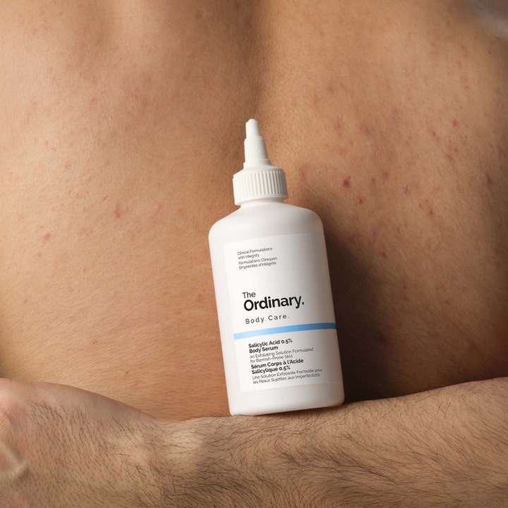 The Ordinary Salicylic Acid 0.5% Body Serum 240 ml eksfolierende kropsserum i hvid flaske mod uren hud på ryg.
