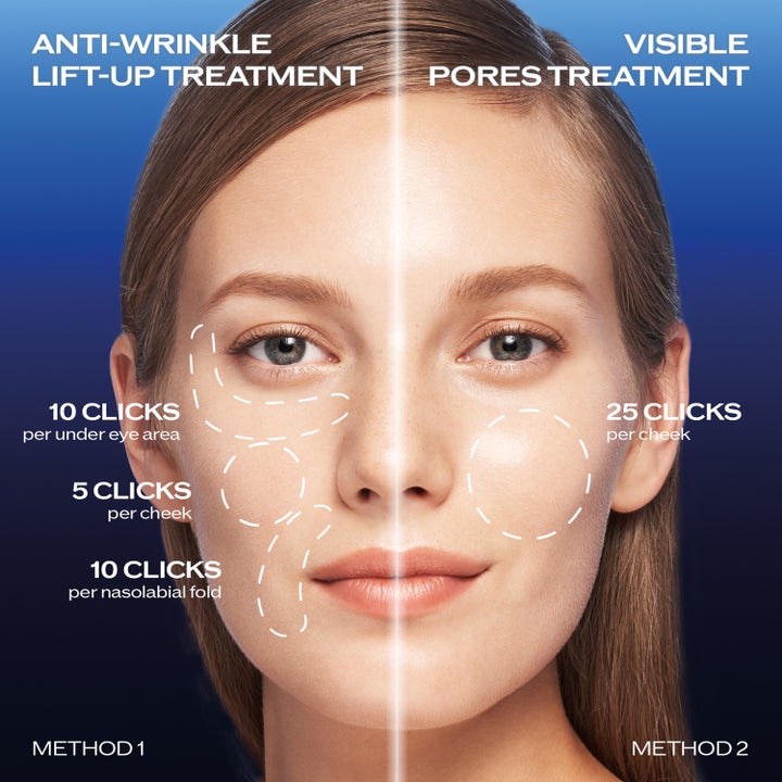 Shiseido Bio Performance 2.0 Micro Needle 1,4 ml spot treatment viser påføringsmetoder på en kvindes ansigt