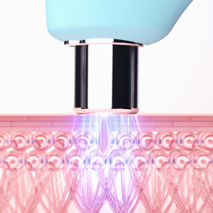 FOREO KIWI 1 stk porerensende beauty tech fjerner urenheder med vakuumteknologi vist i hudens lag