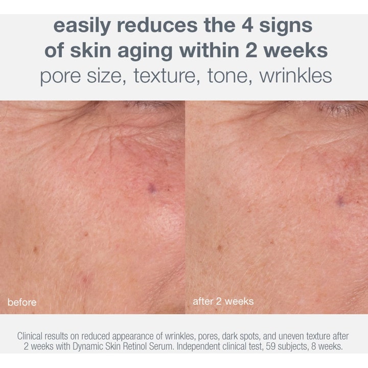 Dermalogica Skin Aging Solutions 70 ml serum viser før og efter resultater på rynker og porer efter to uger.