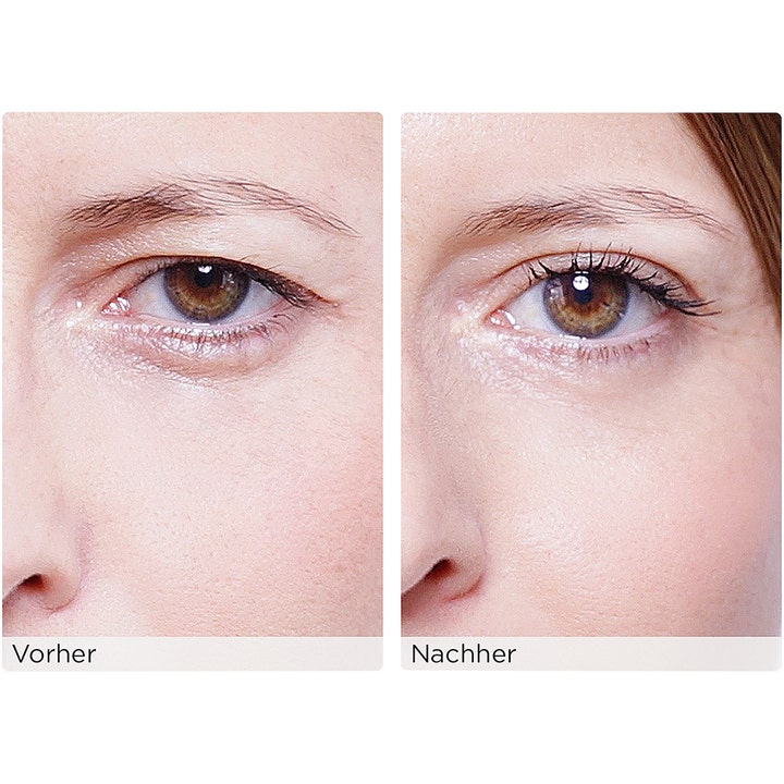 Wonderstripes The Instant Eye Lift Without Surgery Small 64 stk giver et øjenlågsløft vist i før og efter resultat