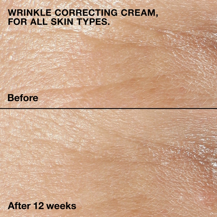 Clinique Smart Clinical Repair 50 ml rynkereducerende dagcreme før og efter billede viser glattere hud efter 12 uger
