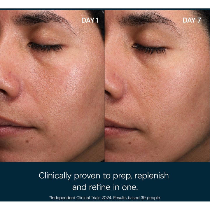 Elemis Pro-Collagen Toning Mist 150 ml ansigtsmist viser før og efter resultat af forfinet hud efter 7 dage.