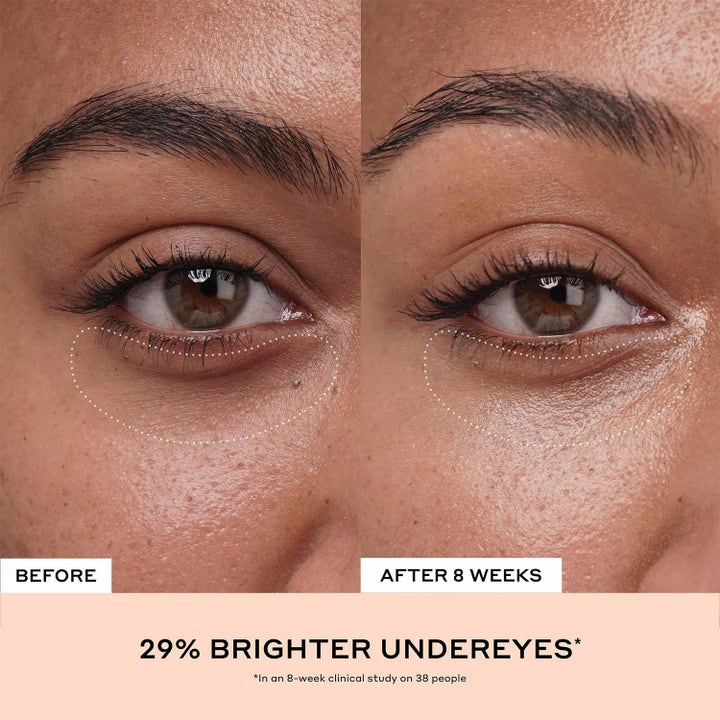 Ole Henriksen Truth Banana Bright + Eye Crème 15 ml øjencreme før og efter billede viser 29% lysere hud under øjnene