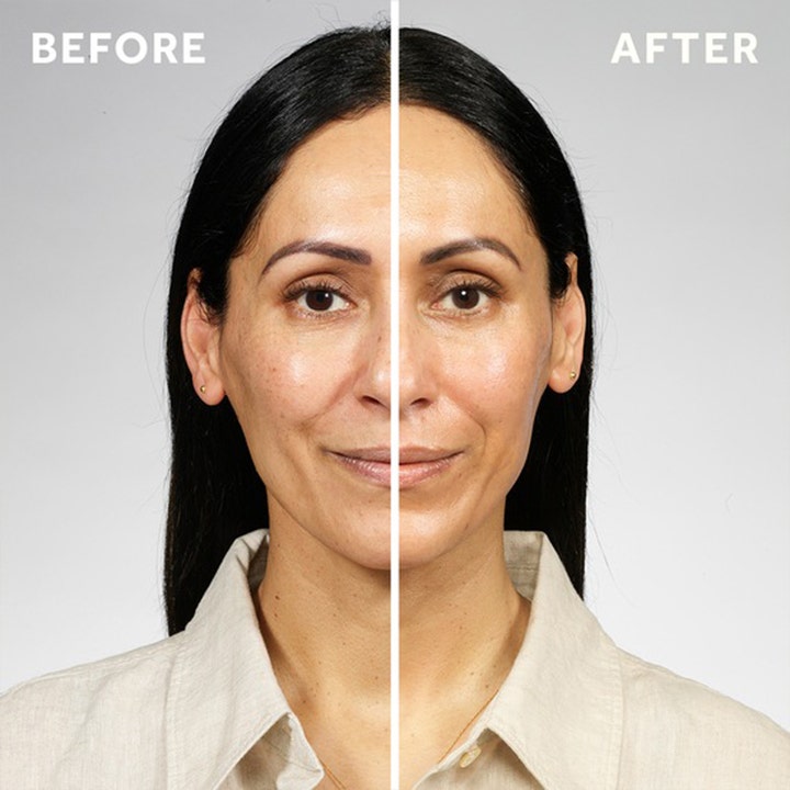 No7 Pure Retinol Triple Action Day Cream Duo 100 ml dagcreme viser før og efter resultat med glattere hud og færre rynker.