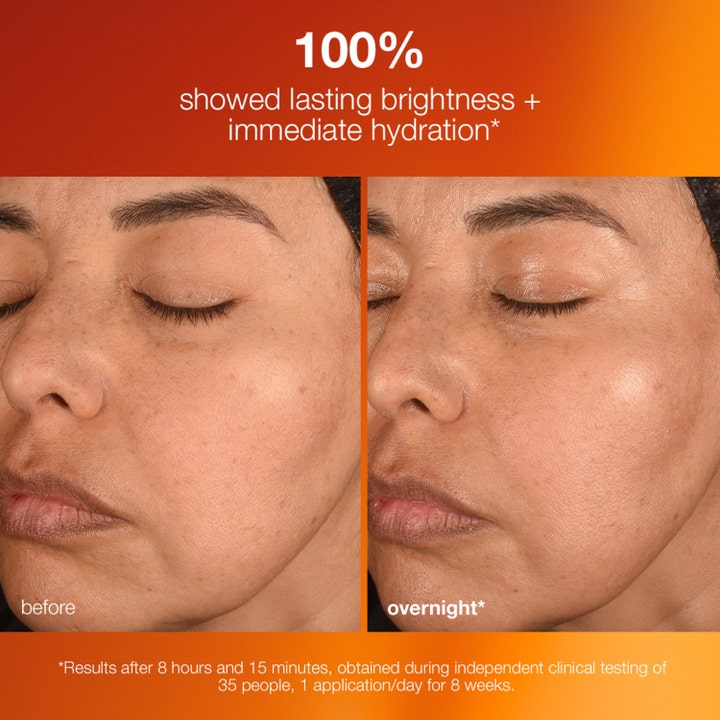 Dermalogica Biolumin-C Night Restore 25 ml serum viser før og efter resultat med øget glød og fugtgivende effekt.