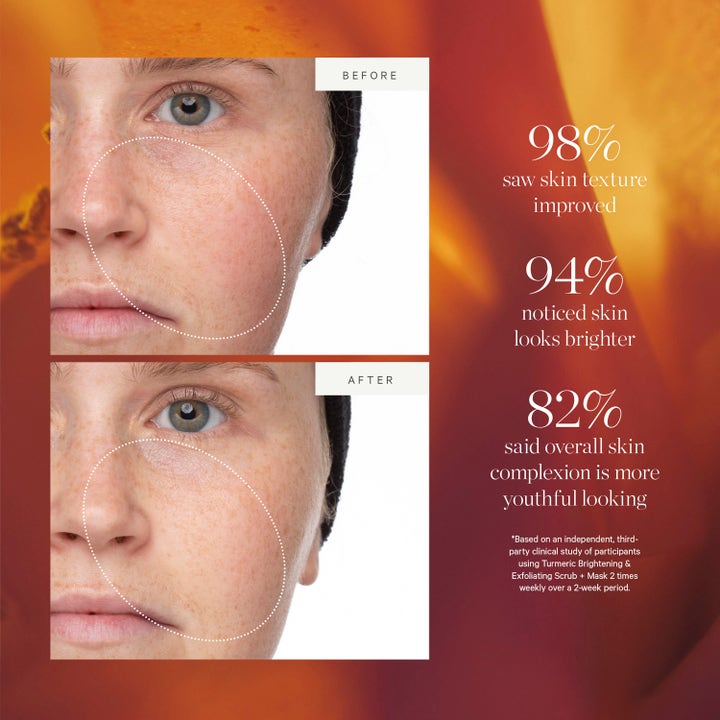 KORA Organics Turmeric Brightening Scrub & Mask 30 ml ansigtsskrub før og efter billeder viser 94% lysere og glattere hud