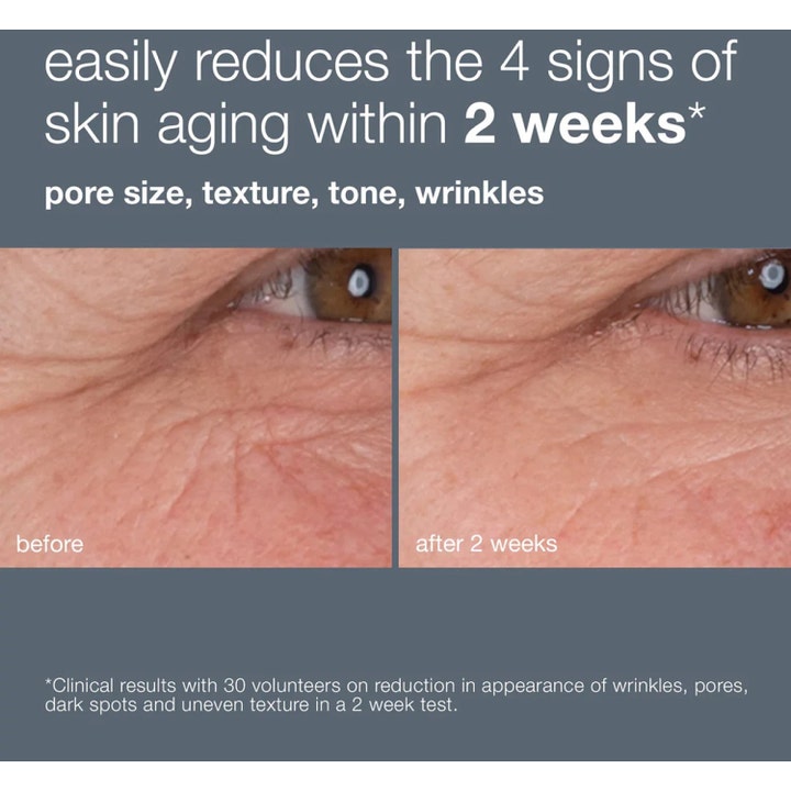 Dermalogica Dynamic Skin Retinol Serum 10 ml før og efter billeder der viser reduktion af rynker og porer på 2 uger