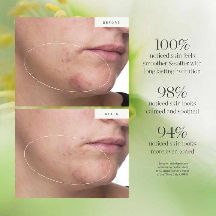 KORA Organics Active Algae Lightweight Moisturizer 50 ml fugtgivende ansigtscreme før og efter resultater for jævn hudtone
