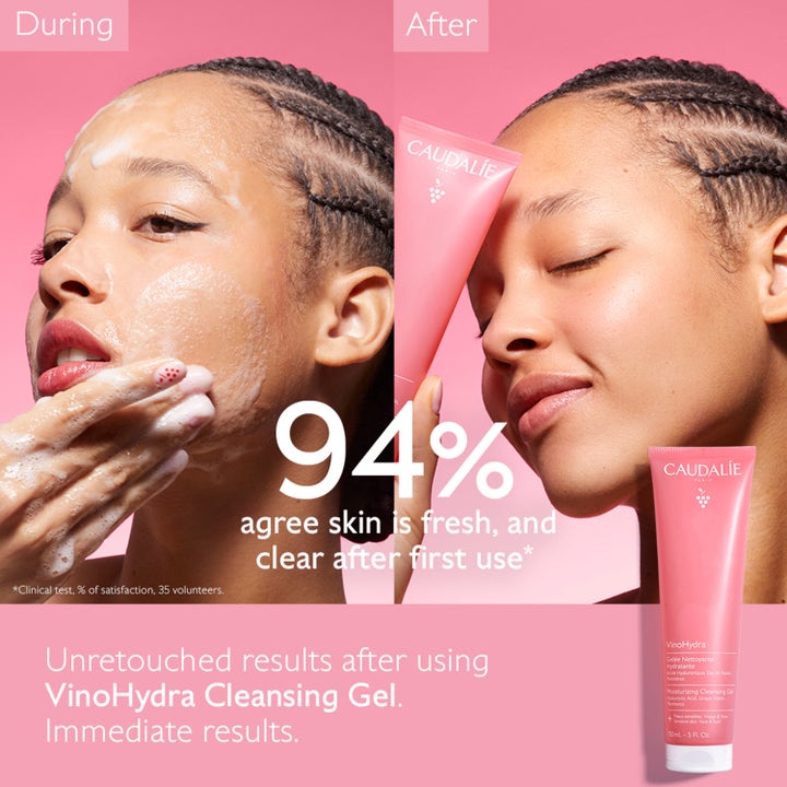 Caudalie Vinohydra Moisturizing Cleansing Gel 150 ml ansigtsrens giver frisk hud vist via før og efter billeder