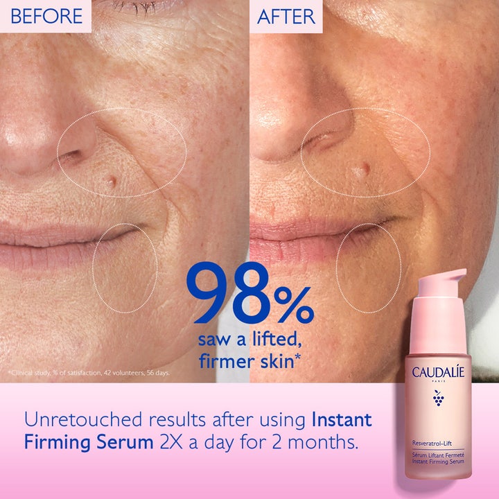 Caudalie Resveratrol Lift Instant Firming Serum 30 ml opstrammende serum før og efter resultater med 98 procent fastere hud