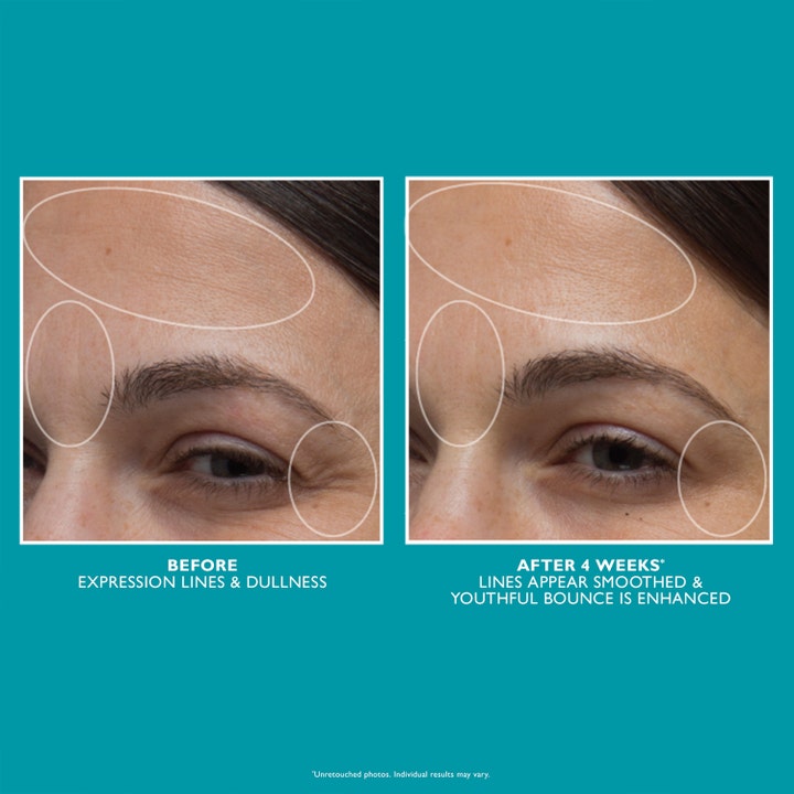 Peter Thomas Roth Peptide Skinjection 50 ml fugtgivende ansigtscreme før og efter resultat der viser glattere hud
