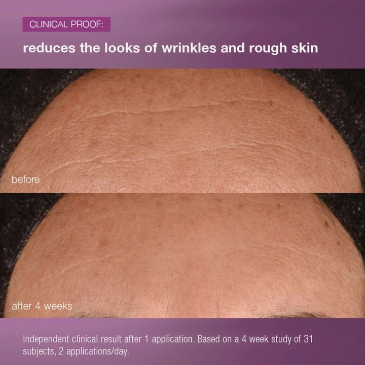 Dermalogica MultiVitamin Power Recovery Cream 50 ml natcreme viser før og efter resultat på rynker efter 4 uger