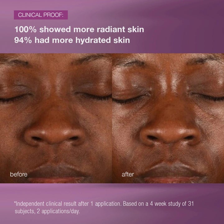 Dermalogica MultiVitamin Power Recovery Cream Duo kliniske før og efter resultater for mere strålende og fugtet hud.