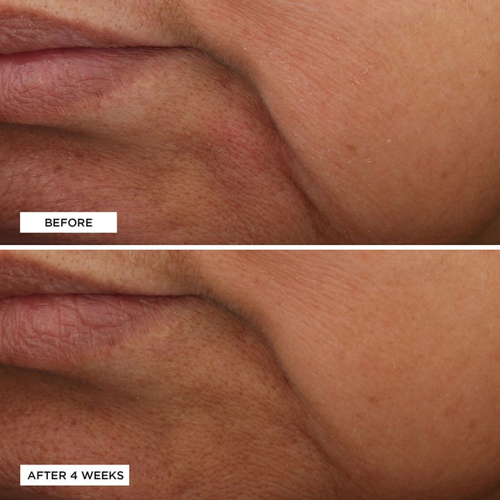 Essential Fx Acyl-Glutathione
