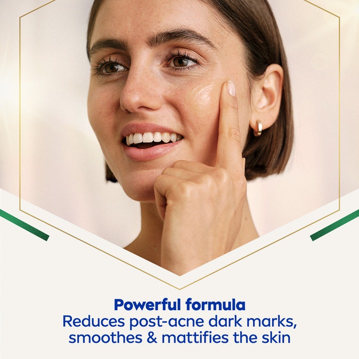 NIVEA LUMINOUS 630 Post-Acne Marks Serum 30 ml mod mørke pletter påføres af kvinde for en mat effekt