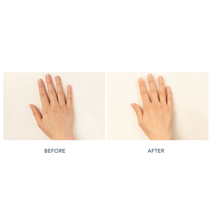 FAQ Swiss FAQ 221 LED Hand Mask før og efter billeder viser en mere jævn hudtone på hænderne.