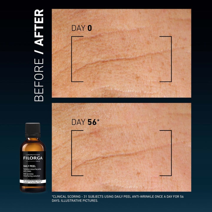 Daily Peel Anti-Wrinkle Resurfacing Solution