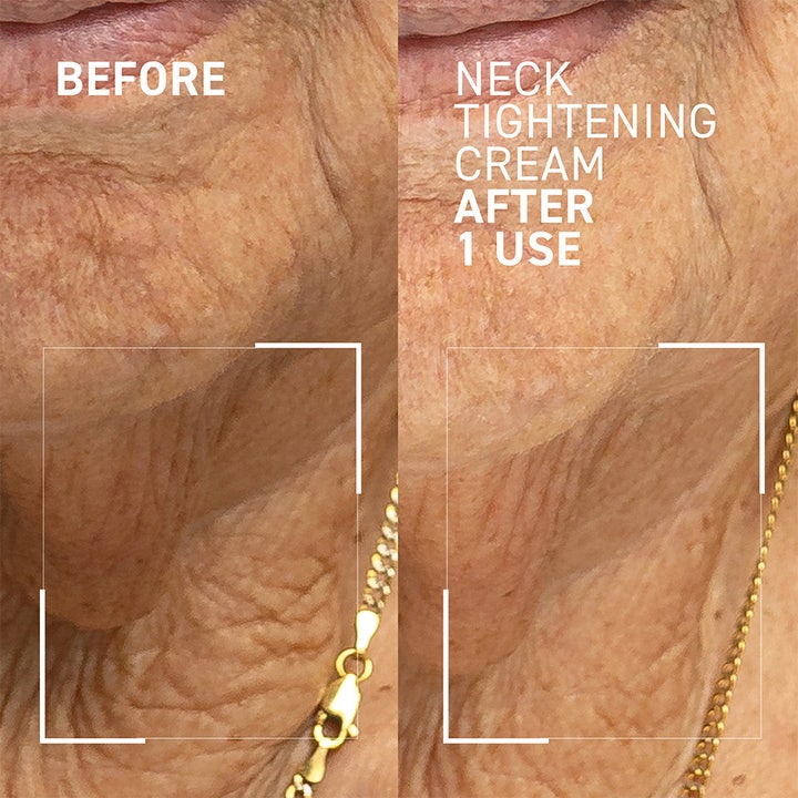 Dr Brandt Neck Tightening Cream 50 g opstrammende halscreme viser før og efter resultat efter én brug.