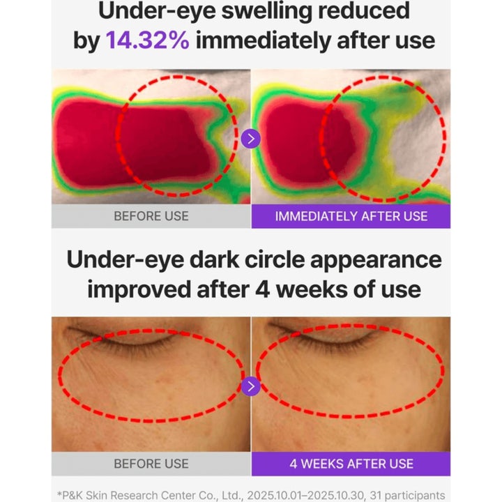 360º Shot PDRN glowing eye patches