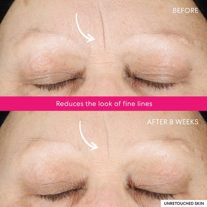 bareMinerals Ageless Phyto-AHA Radiance Facial 50 ml serum før og efter resultat af reducerede linjer efter 8 uger.