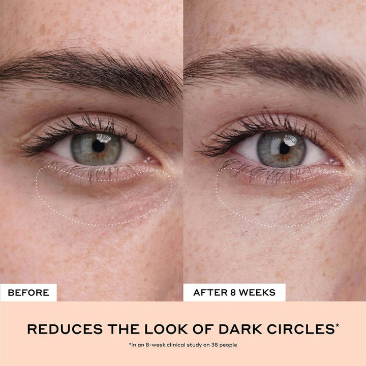 Ole Henriksen Truth Banana Bright + Eye Crème 15 ml øjencreme mindsker mørke rande vist i før og efter-billede