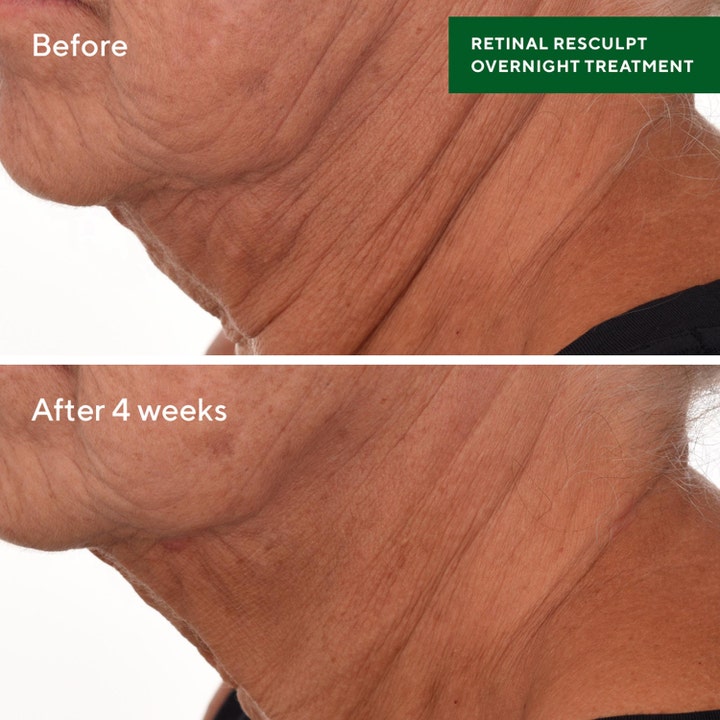Murad Retinal ReSculpt Treatment 30 ml serum viser før og efter resultat med færre rynker på halsen efter 4 uger.