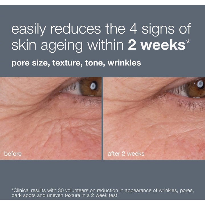 Dermalogica Retinol Renewal Duo 60 ml serum reducerer rynker og porer vist med før og efter-billeder på to uger