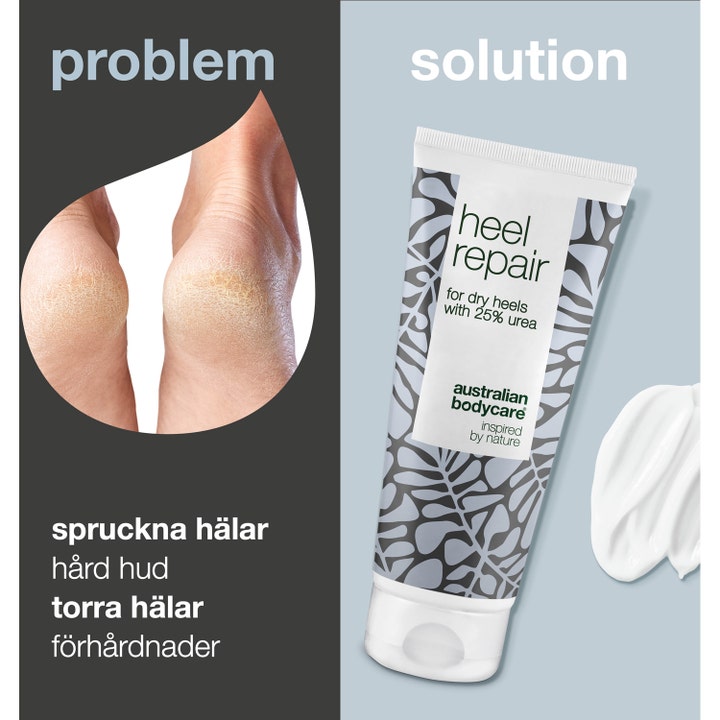 Australian Bodycare Heel Repair 100 ml mod tørre hæle og hård hud viser før og efter resultat med tube og hvid creme.