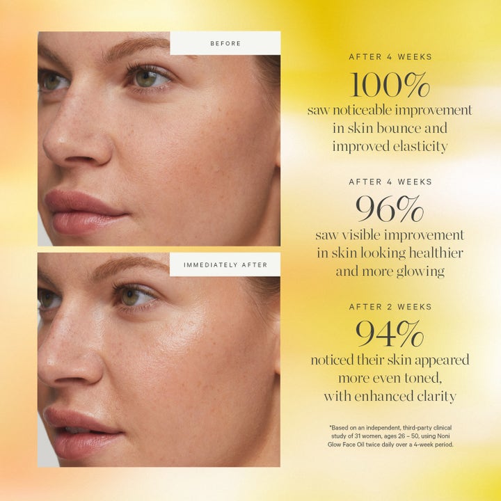 KORA Organics Noni Glow Face Oil 30 ml ansigtsolie før og efter sammenligning der viser øget glød og elasticitet