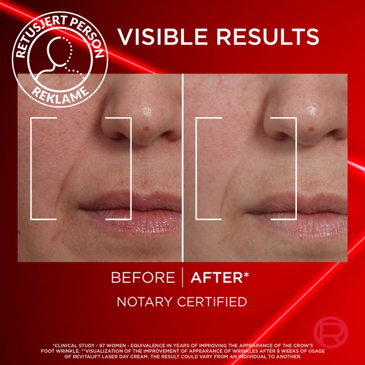 L'Oréal Paris Laser Advance Day 50 ml dagcreme giver fylde og fastere hud vist med klinisk dokumenterede resultater.