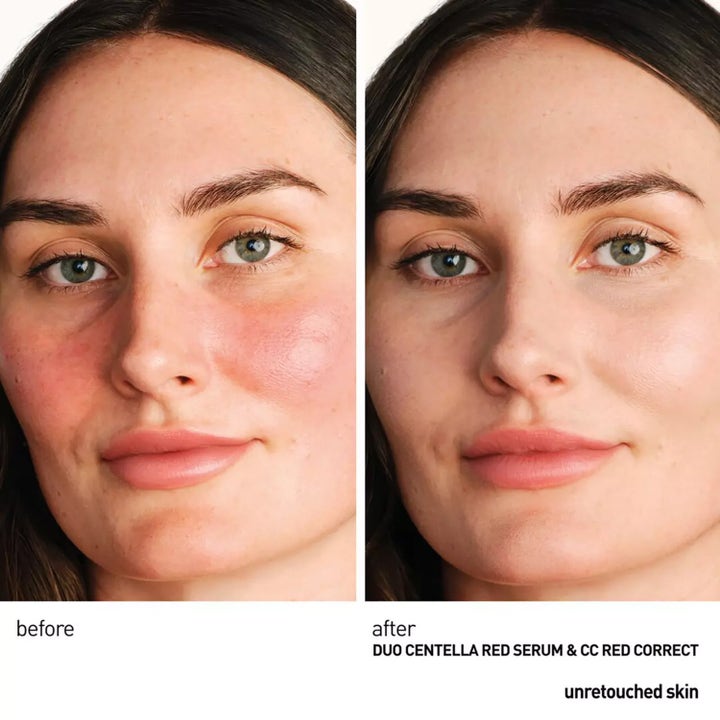 Centella Red Serum