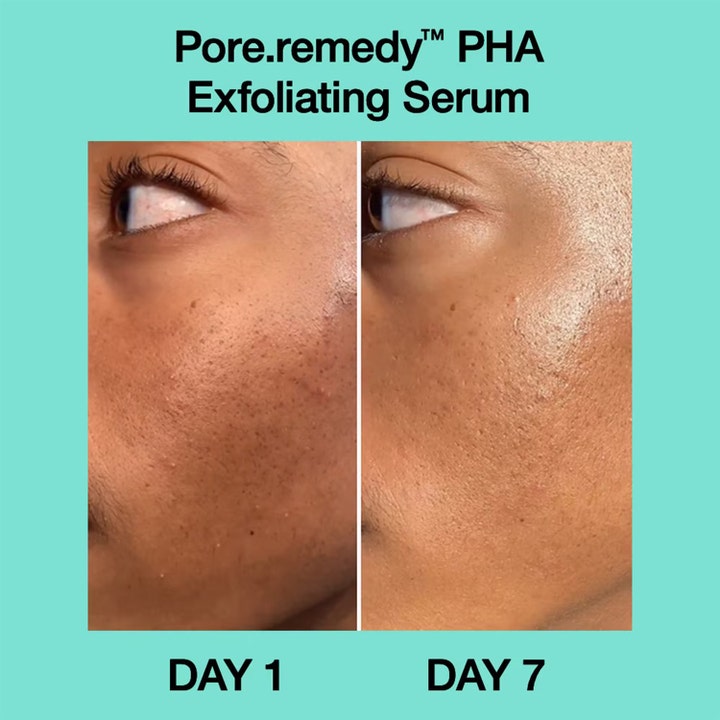 Dr.Jart+ Pore-remedy PHA Exfoliating Serum 30 ml viser før og efter resultat på hud med synlige porer efter 7 dage.