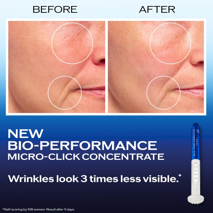 Shiseido Bio Performance 2.0 Micro Needle 1,4 ml anti-age spot treatment i blå pen mindsker synlige rynker.