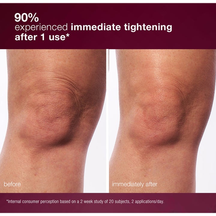 Dermalogica Dynamic Skin Sculptor Duo før og efter billede der viser opstrammende effekt på knæet